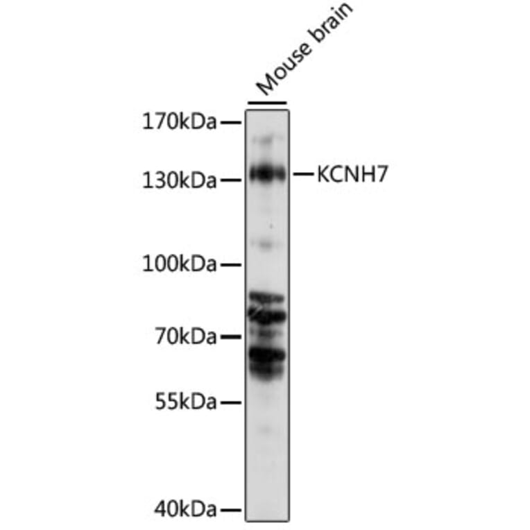 Western Blot - Anti-KCNH7 Antibody (A88182) - Antibodies.com