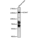 Western Blot - Anti-KCNH7 Antibody (A88182) - Antibodies.com