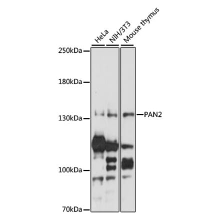 Western Blot - Anti-Pan2 Antibody (A88184) - Antibodies.com