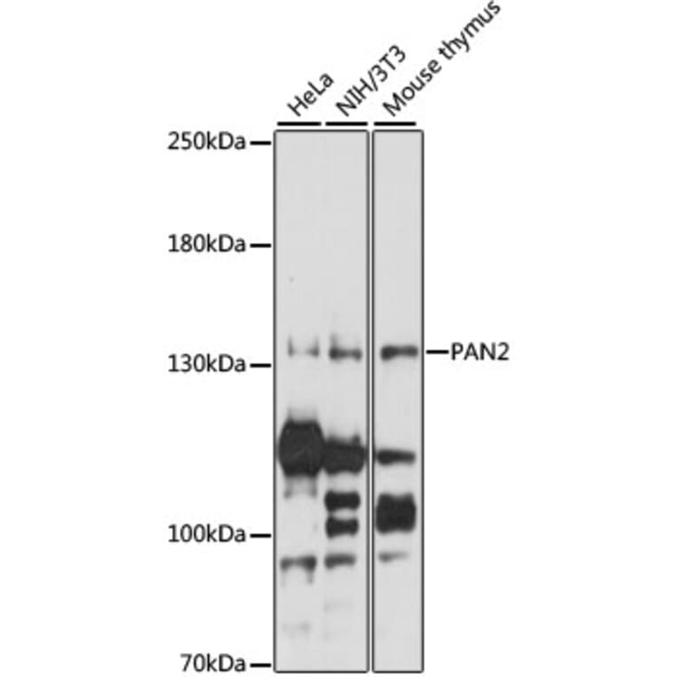 Western Blot - Anti-Pan2 Antibody (A88184) - Antibodies.com