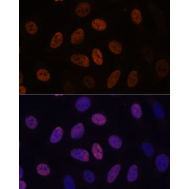 Immunofluorescence - Anti-WDHD1 Antibody (A88185) - Antibodies.com