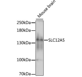 Western Blot - Anti-KCC2 Antibody (A88186) - Antibodies.com