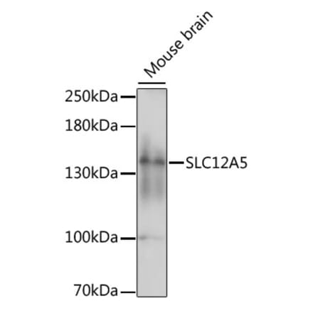 Western Blot - Anti-KCC2 Antibody (A88186) - Antibodies.com