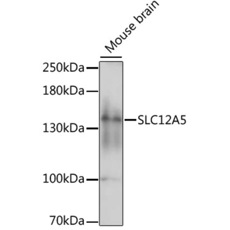 Western Blot - Anti-KCC2 Antibody (A88186) - Antibodies.com