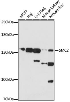Western blot analysis of extracts of various cells, using Anti-SMC2 Antibody (A17867) at 1:1,000 dilution.
Secondary antibody: Goat Anti-Rabbit IgG (H+L) (HRP) (AS014) at 1:10,000 dilution.
Lysates / proteins: 25µg per lane.
Blocking buffer: 3% non-fat dry milk in TBST.
Detection: ECL Basic Kit (RM00020).
Exposure time: 30s.