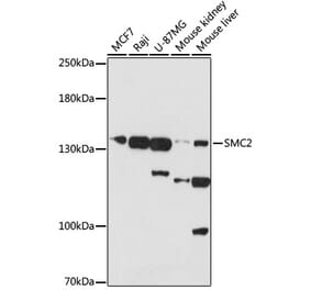 Western Blot - Anti-SMC2 Antibody (A88187) - Antibodies.com