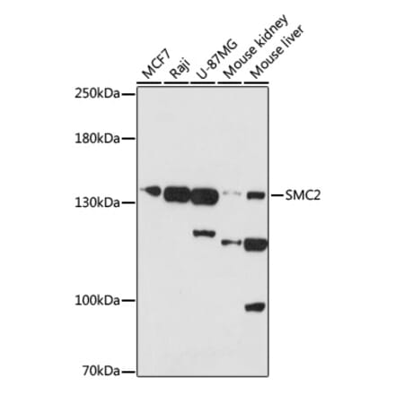 Western Blot - Anti-SMC2 Antibody (A88187) - Antibodies.com