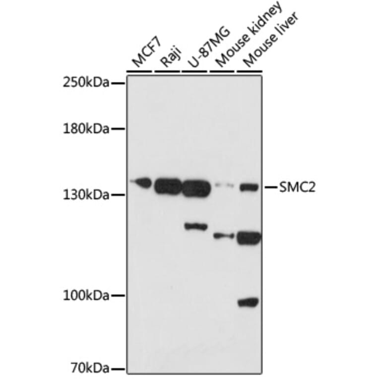 Western Blot - Anti-SMC2 Antibody (A88187) - Antibodies.com