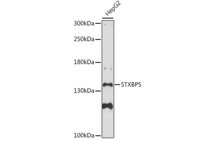 Western Blot - Anti-Tomosyn Antibody (A88188) - Antibodies.com