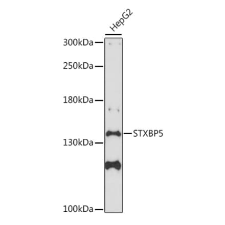 Western Blot - Anti-Tomosyn Antibody (A88188) - Antibodies.com