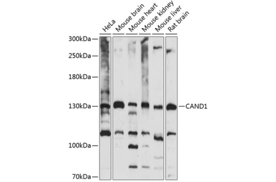 Western Blot - Anti-CAND1 Antibody (A88190) - Antibodies.com