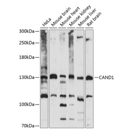 Western Blot - Anti-CAND1 Antibody (A88190) - Antibodies.com