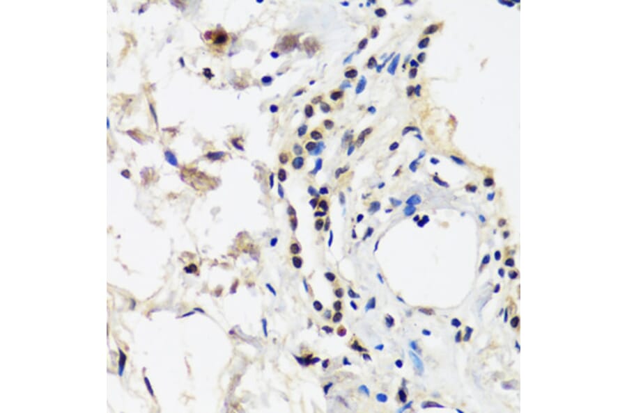 Immunohistochemistry - Anti-CAND1 Antibody (A88190) - Antibodies.com