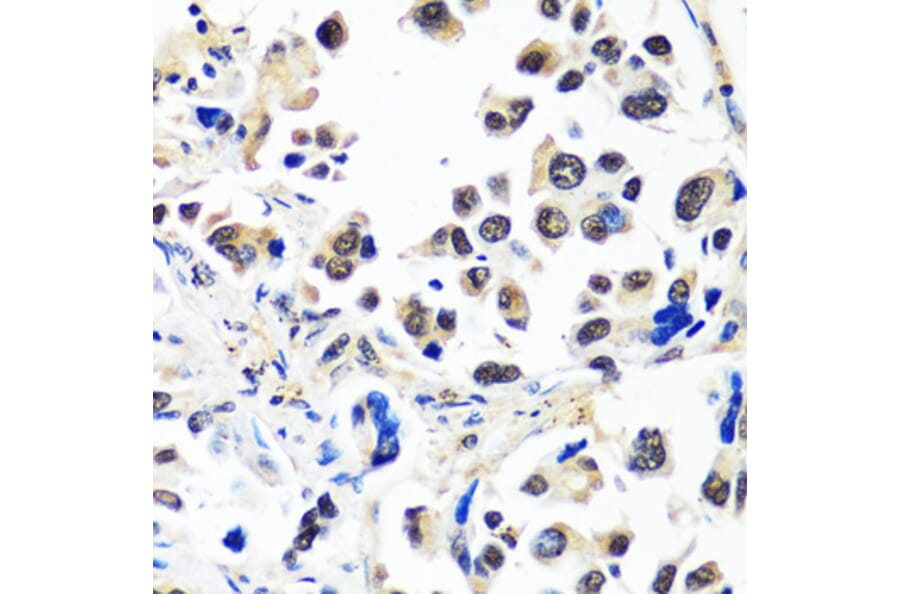 Immunohistochemistry - Anti-CAND1 Antibody (A88190) - Antibodies.com