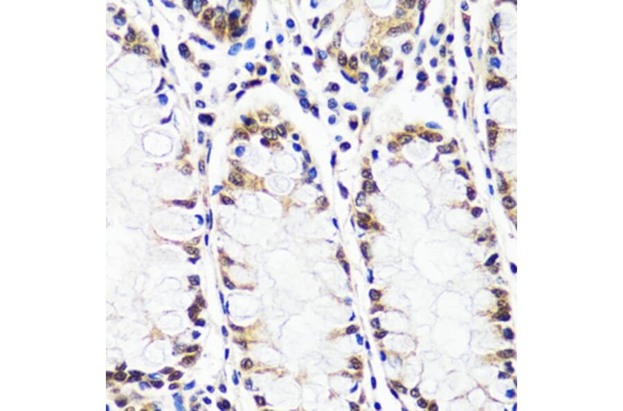 Immunohistochemistry - Anti-CAND1 Antibody (A88190) - Antibodies.com