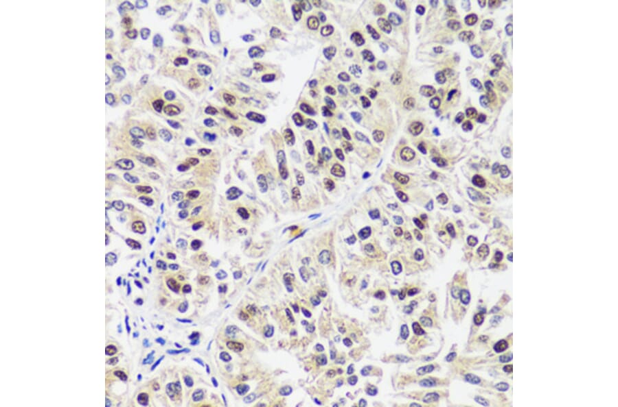 Immunohistochemistry - Anti-CAND1 Antibody (A88190) - Antibodies.com