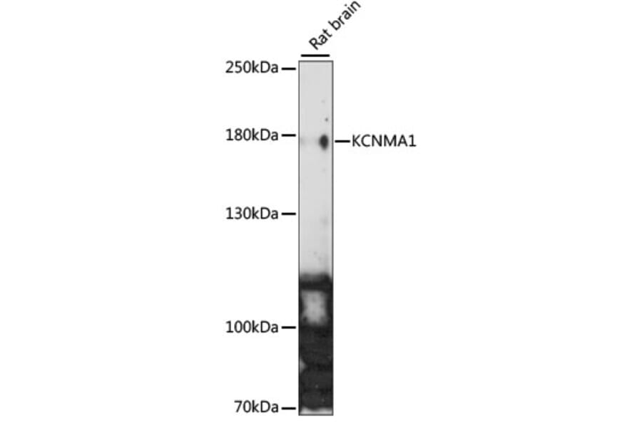 Western Blot - Anti-Maxi Potassium channel alpha/SLO Antibody (A88191) - Antibodies.com