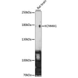 Western Blot - Anti-Maxi Potassium channel alpha/SLO Antibody (A88191) - Antibodies.com