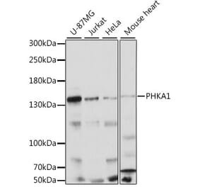 Western Blot - Anti-PHKA1 Antibody (A88192) - Antibodies.com