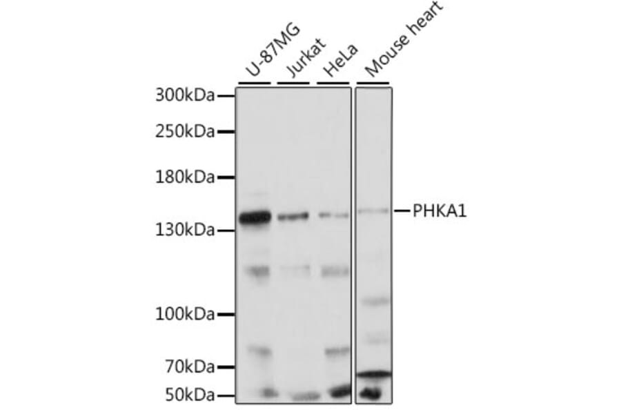 Western Blot - Anti-PHKA1 Antibody (A88192) - Antibodies.com