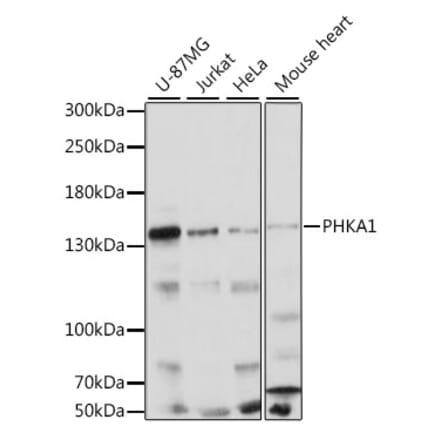 Western Blot - Anti-PHKA1 Antibody (A88192) - Antibodies.com