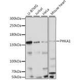 Western Blot - Anti-PHKA1 Antibody (A88192) - Antibodies.com