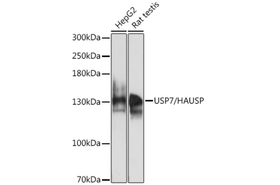 Western Blot - Anti-HAUSP/USP7 Antibody (A88193) - Antibodies.com