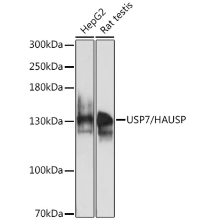 Western Blot - Anti-HAUSP/USP7 Antibody (A88193) - Antibodies.com