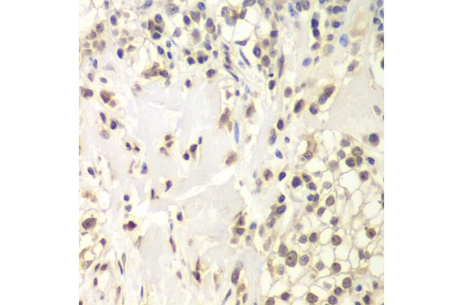 Immunohistochemistry - Anti-HAUSP/USP7 Antibody (A88193) - Antibodies.com