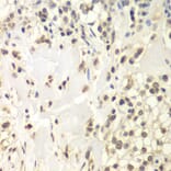 Immunohistochemistry - Anti-HAUSP/USP7 Antibody (A88193) - Antibodies.com