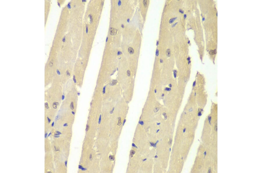 Immunohistochemistry - Anti-HAUSP/USP7 Antibody (A88193) - Antibodies.com