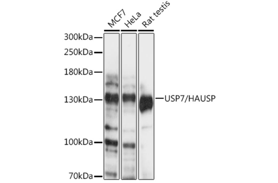 Western Blot - Anti-HAUSP / USP7 Antibody (A88194) - Antibodies.com