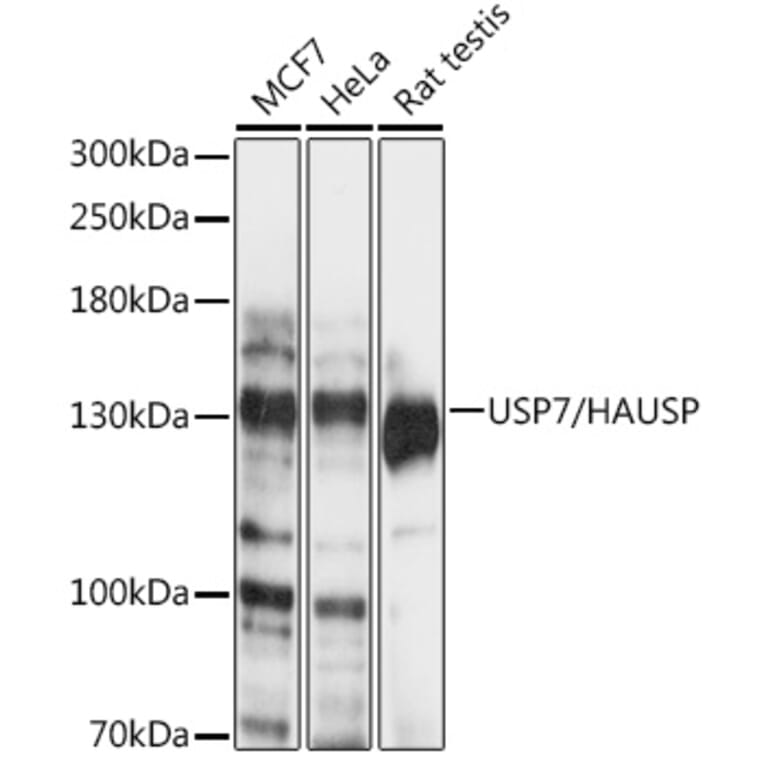Western Blot - Anti-HAUSP / USP7 Antibody (A88194) - Antibodies.com