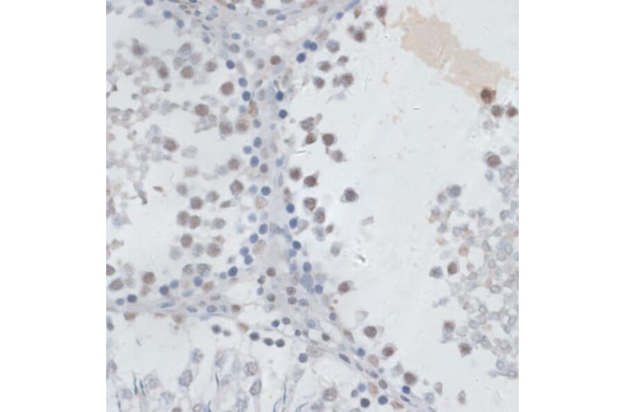 Immunohistochemistry - Anti-HAUSP / USP7 Antibody (A88194) - Antibodies.com