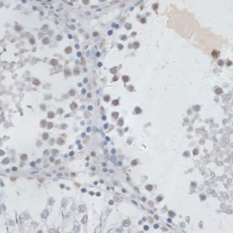 Immunohistochemistry - Anti-HAUSP / USP7 Antibody (A88194) - Antibodies.com