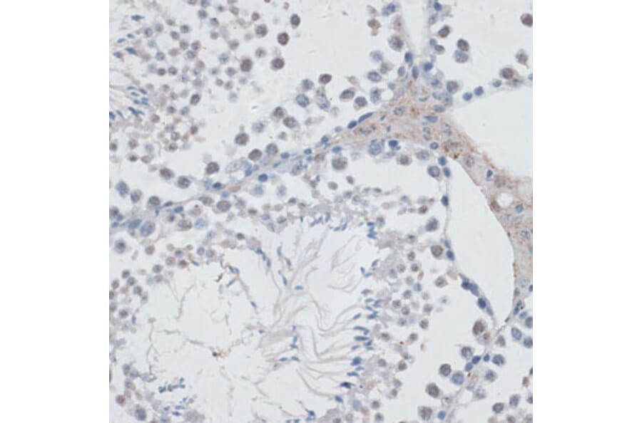 Immunohistochemistry - Anti-HAUSP / USP7 Antibody (A88194) - Antibodies.com