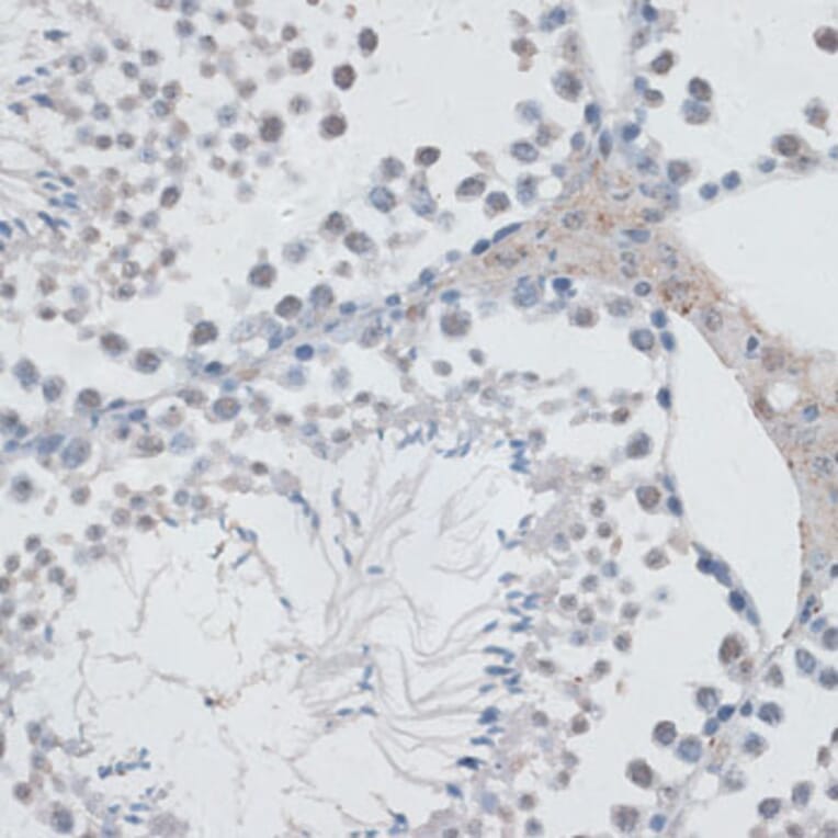 Immunohistochemistry - Anti-HAUSP / USP7 Antibody (A88194) - Antibodies.com