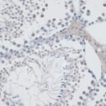 Immunohistochemistry - Anti-HAUSP / USP7 Antibody (A88194) - Antibodies.com
