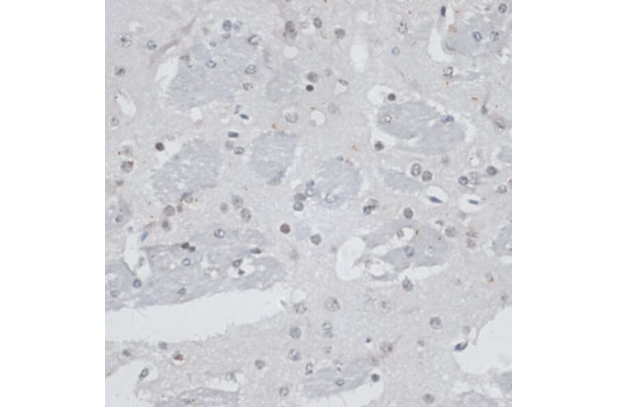 Immunohistochemistry - Anti-HAUSP / USP7 Antibody (A88194) - Antibodies.com