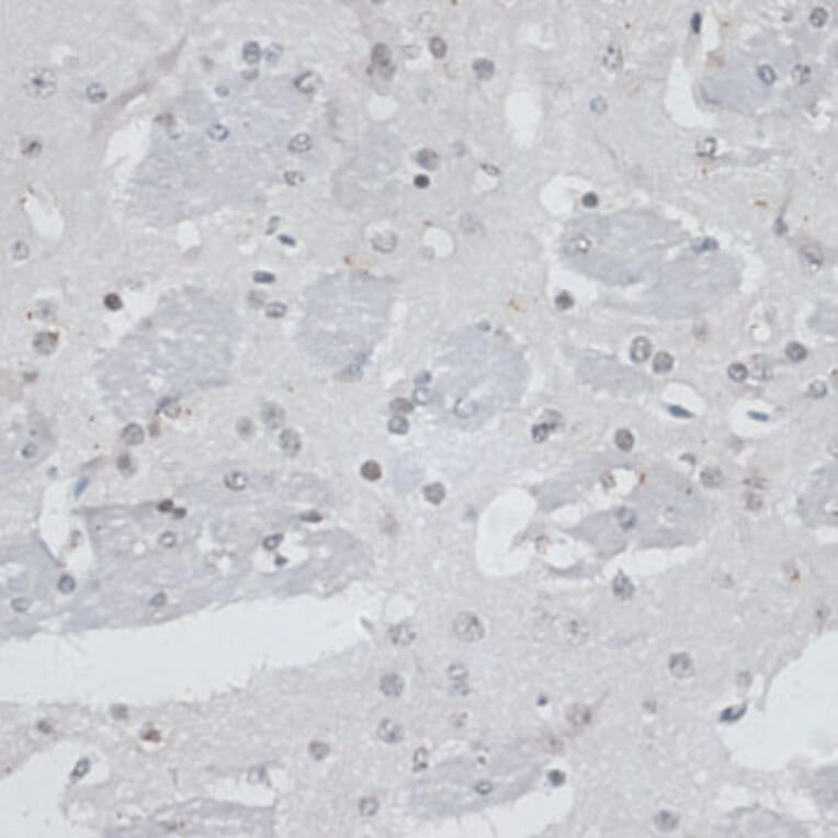 Immunohistochemistry - Anti-HAUSP / USP7 Antibody (A88194) - Antibodies.com