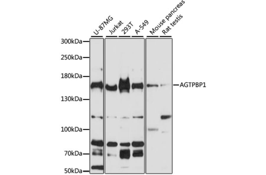 Western Blot - Anti-AGTPBP1 Antibody (A13081) - Antibodies.com