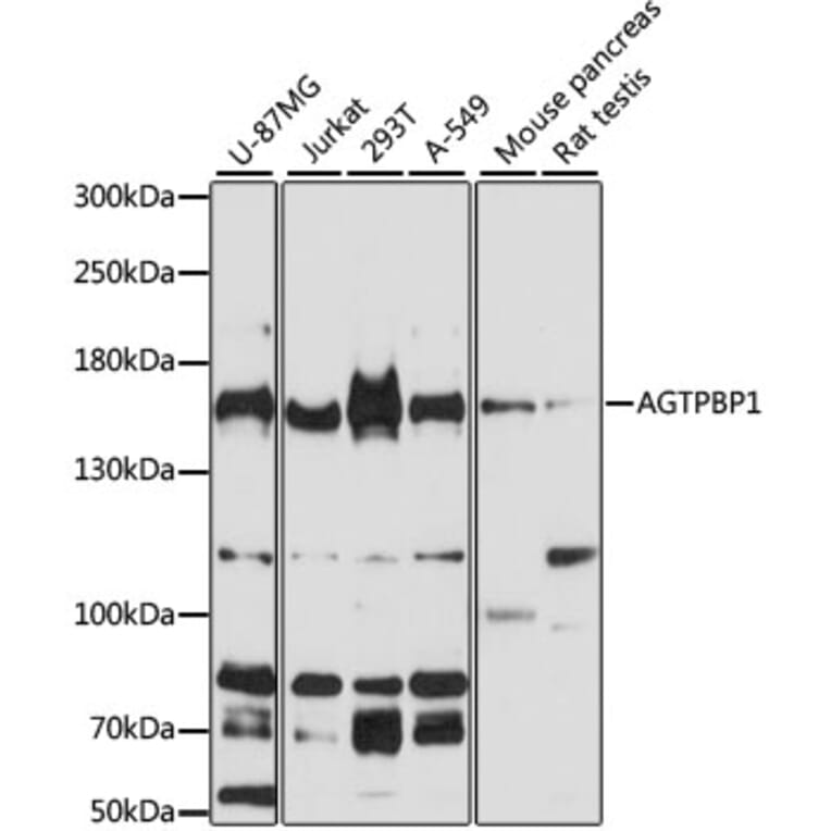Western Blot - Anti-AGTPBP1 Antibody (A13081) - Antibodies.com