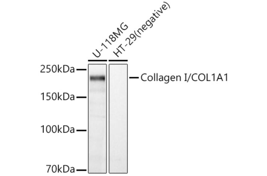 Western Blot - Anti-Collagen I Antibody (A88196) - Antibodies.com