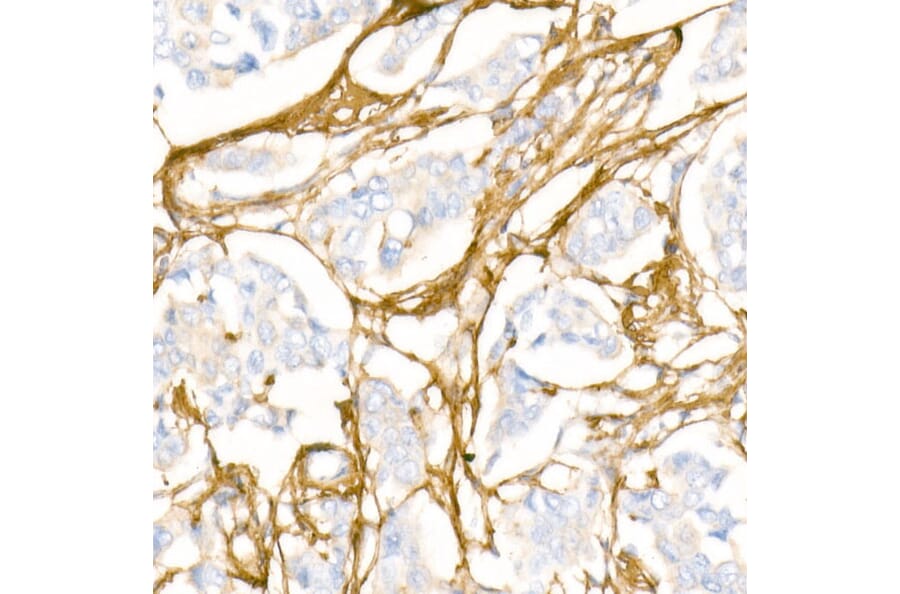 Immunohistochemistry - Anti-Collagen I Antibody (A88196) - Antibodies.com