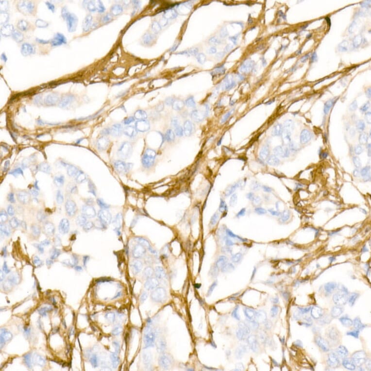 Immunohistochemistry - Anti-Collagen I Antibody (A88196) - Antibodies.com