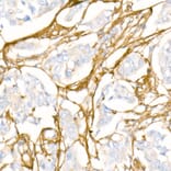 Immunohistochemistry - Anti-Collagen I Antibody (A88196) - Antibodies.com