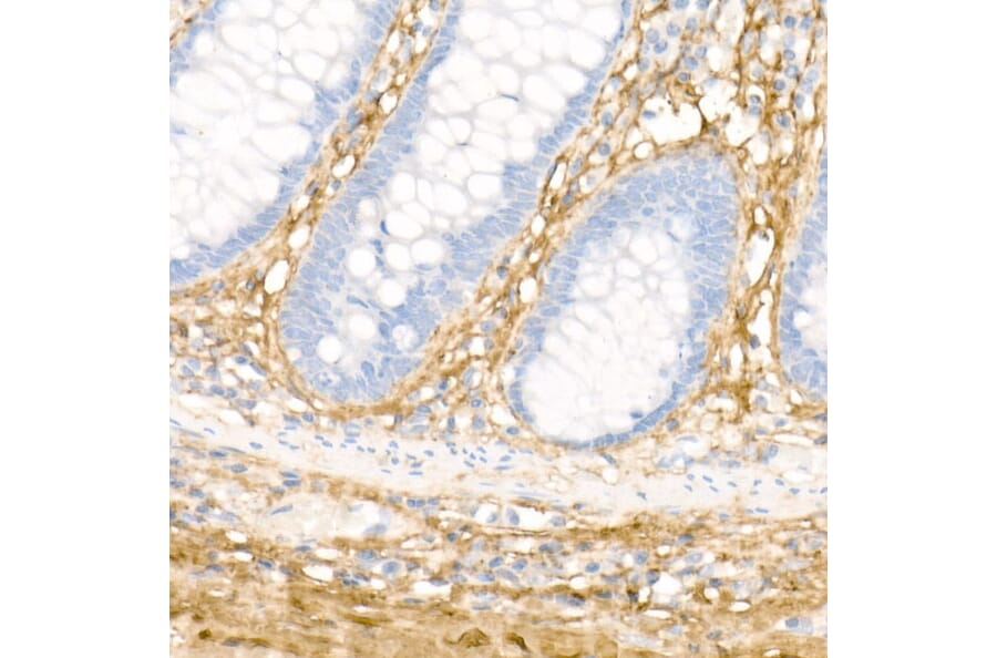 Immunohistochemistry - Anti-Collagen I Antibody (A88196) - Antibodies.com