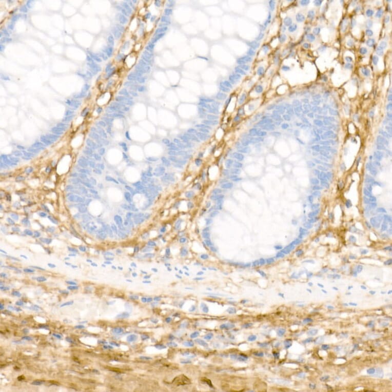 Immunohistochemistry - Anti-Collagen I Antibody (A88196) - Antibodies.com