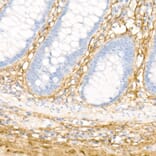 Immunohistochemistry - Anti-Collagen I Antibody (A88196) - Antibodies.com