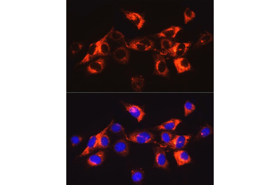 Immunofluorescence - Anti-Collagen I Antibody (A88196) - Antibodies.com